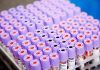 NeoGenesis Capital launches debut fund targeting Colossal Biosciences spinouts